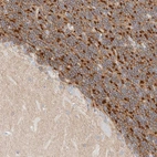 Anti-HEXDC Antibody