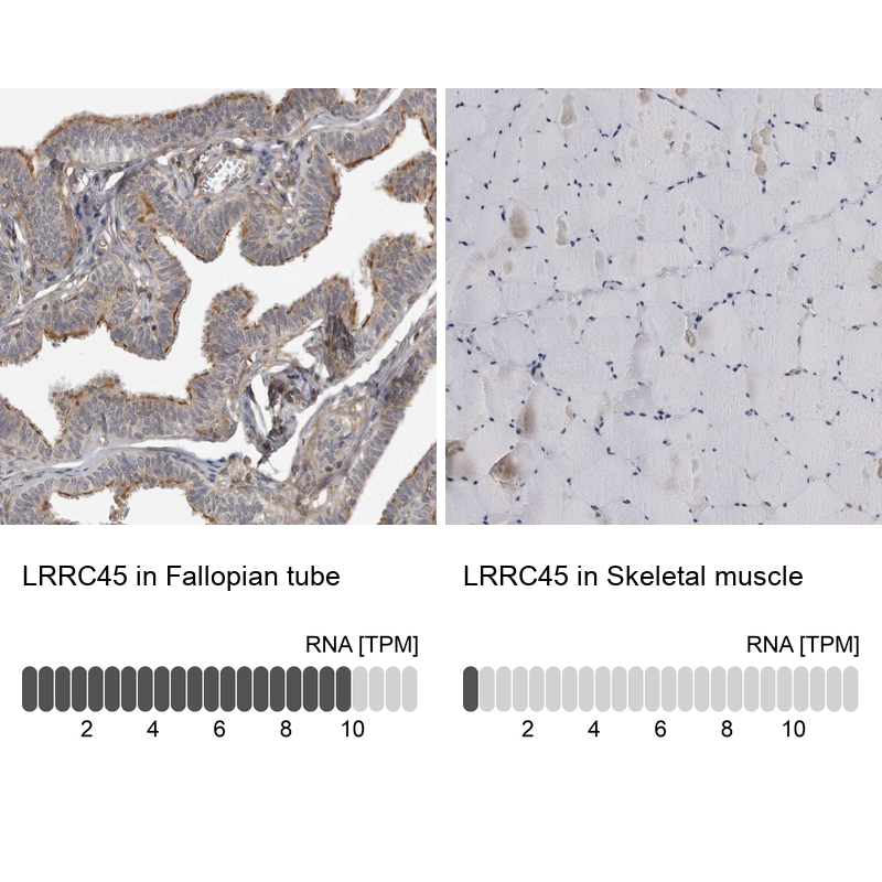 Anti-LRRC45 Antibody