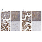 Immunohistochemical staining of human fallopian tube, lymph node, placenta and skeletal muscle using Anti-LRRC45 antibody HPA023382 (A) shows similar protein distribution across tissues to independent antibody HPA023372 (B).