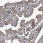Immunohistochemical staining of human fallopian tube shows high expression.