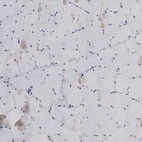 Immunohistochemical staining of human skeletal muscle shows low expression as expected.