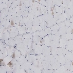Immunohistochemical staining of human skeletal muscle shows low expression as expected.