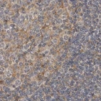 Immunohistochemical staining of human lymph node using Anti-LRRC45 antibody HPA023382.