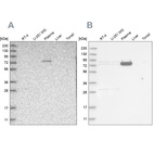 Western blot analysis using Anti-LRRC45 antibody HPA023382 (A) shows similar pattern to independent antibody HPA024768 (B).