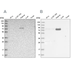 Western blot analysis using Anti-LRRC45 antibody HPA023382 (A) shows similar pattern to independent antibody HPA024768 (B).