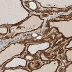 Immunohistochemical staining of human thyroid gland shows strong cytoplasmic positivity in glandular cells.