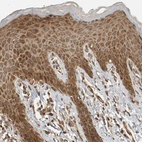 Immunohistochemical staining of human skin shows moderate cytoplasmic positivity in epidermal cells.