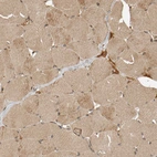 Immunohistochemical staining of human skeletal muscle shows weak cytoplasmic positivity in myocytes.