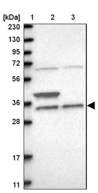 Lane 1: Marker [kDa] 230, 130, 95, 72, 56, 36, 28, 17, 11_br/_Lane 2: Human cell line RT-4_br/_Lane 3: Human cell line U-251MG sp