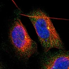 Immunofluorescent staining of human cell line U-251 MG shows localization to cytosol & centrosome.
