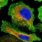Immunofluorescent staining of human cell line U-2 OS shows positivity in plasma membrane.