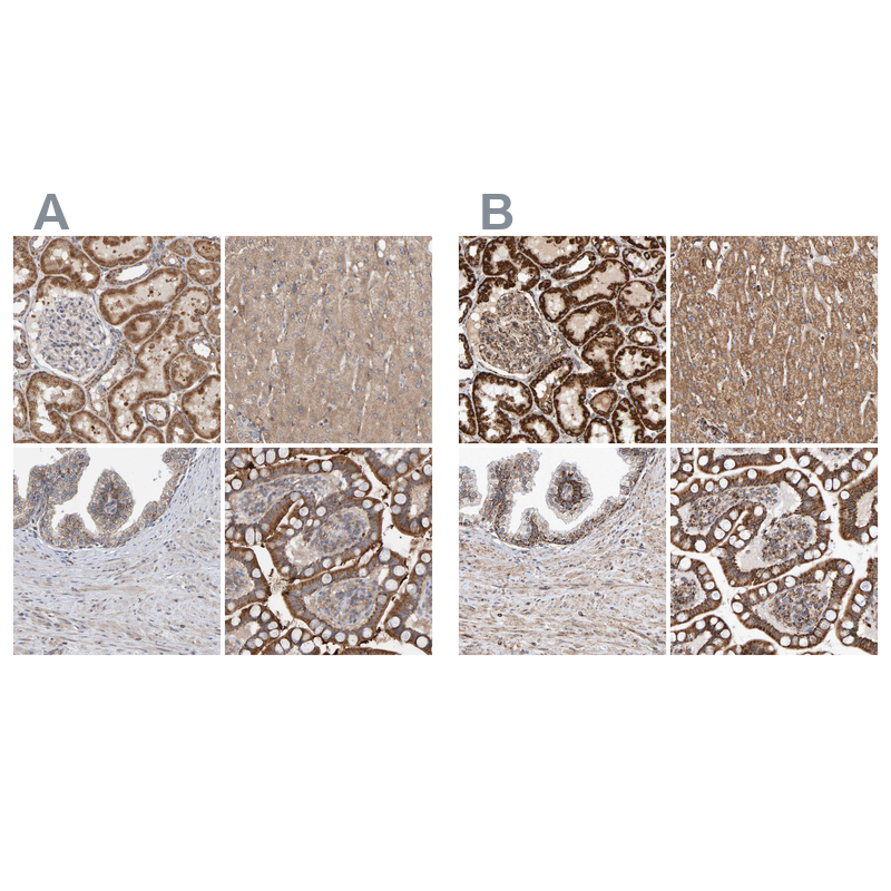 Anti-MRPL45 Antibody