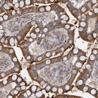 Immunohistochemical staining of human small intestine strong granular cytoplasmic positivity in glandular cells.