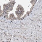 Immunohistochemical staining of human prostate shows moderate granular cytoplasmic positivity in glandular cells.