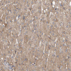 Immunohistochemical staining of human liver shows moderate granular cytoplasmic positivity in hepatocytes.