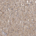 Immunohistochemical staining of human liver shows moderate granular cytoplasmic positivity in hepatocytes.