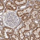 Immunohistochemical staining of human kidney shows strong granular cytoplasmic positivity in cells in tubules.