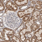 Immunohistochemical staining of human kidney shows strong granular cytoplasmic positivity in cells in tubules.