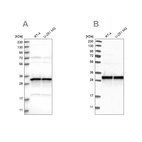Western blot analysis using Anti-MRPL45 antibody HPA023385 (A) shows similar pattern to independent antibody HPA023373 (B).