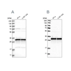 Western blot analysis using Anti-MRPL45 antibody HPA023385 (A) shows similar pattern to independent antibody HPA023373 (B).