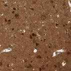 Immunohistochemical staining of human cerebral cortex shows strong positivity in nucleoli in neuronal cells.