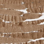 Immunohistochemical staining of human skeletal muscle shows strong cytoplasmic positivity in myocytes.