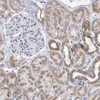 Immunohistochemical staining of human kidney shows moderate cytoplasmic positivity in cells in tubules.