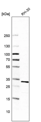 Western blot analysis in human cell line RH-30.