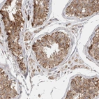 Anti-C17orf53 Antibody