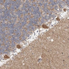 Immunohistochemical staining of human cerebellum shows moderate cytoplasmic positivity in Purkinje cells.