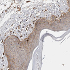 Immunohistochemical staining of human skin shows moderate cytoplasmic positivity in squamous epithelial cells.