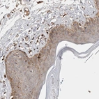 Immunohistochemical staining of human skin shows moderate cytoplasmic positivity in squamous epithelial cells.