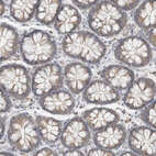 Immunohistochemical staining of human colon shows moderate cytoplasmic positivity in glandular cells.