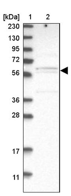 Lane 1: Marker [kDa] 230, 130, 95, 72, 56, 36, 28, 17, 11_br/_Lane 2: Human cell line RT-4