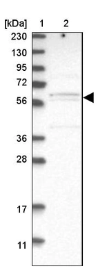 Lane 1: Marker [kDa] 230, 130, 95, 72, 56, 36, 28, 17, 11_br/_Lane 2: Human cell line RT-4