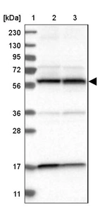 Lane 1: Marker [kDa] 230, 130, 95, 72, 56, 36, 28, 17, 11_br/_Lane 2: Human cell line RT-4_br/_Lane 3: Human cell line U-251MG sp