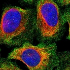 Immunofluorescent staining of human cell line U-2 OS shows localization to vesicles.