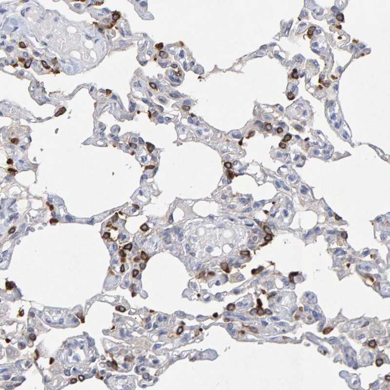 Anti-ZNF77 Antibody