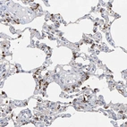 Anti-ZNF77 Antibody