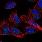 Immunofluorescent staining of human cell line U-251 MG shows localization to nucleus & nucleoli.