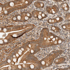 Immunohistochemical staining of human duodenum shows strong cytoplasmic positivity in glandular cells.