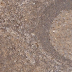 Immunohistochemical staining of human tonsil shows moderate cytoplasmic positivity in non-germinal center cells.