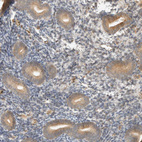 Immunohistochemical staining of human endometrium shows moderate cytoplasmic positivity in glandular cells.