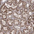 Anti-ZNF324B Antibody