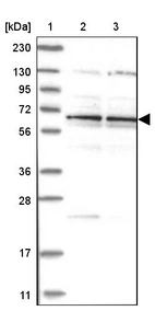 Lane 1: Marker [kDa] 230, 130, 95, 72, 56, 36, 28, 17, 11_br/_Lane 2: Human cell line RT-4_br/_Lane 3: Human cell line U-251MG sp