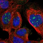 Immunofluorescent staining of human cell line A-431 shows localization to nucleoli.