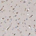 Immunohistochemical staining of human cerebral cortex shows high expression.