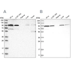 Western blot analysis using Anti-EFR3A antibody HPA023402 (A) shows similar pattern to independent antibody HPA023092 (B).