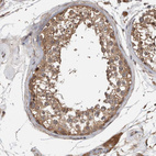 Immunohistochemical staining of human testis shows moderate cytoplasmic positivity in cells in seminiferous ducts.