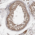 Immunohistochemical staining of human testis shows moderate cytoplasmic positivity in cells in seminiferous ducts.